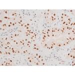 Phospho-JNK1/JNK2/JNK3 (Thr183, Tyr185) Antibody in Immunohistochemistry (Paraffin) (IHC (P))