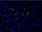 Phospho-LIMK1 (Thr508) Antibody in Immunocytochemistry (ICC/IF)