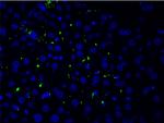 Phospho-LIMK1 (Thr508) Antibody in Immunocytochemistry (ICC/IF)