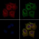 Phospho-LIMK1 (Thr508) Polyclonal Antibody