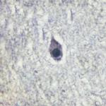 Phospho-Calmodulin 1/2/3 (Thr79, Ser81) Antibody in Immunohistochemistry (Paraffin) (IHC (P))