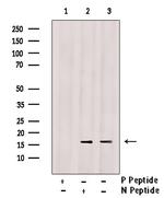 Phospho-Calmodulin 1/2/3 (Thr79, Ser81) Antibody in Western Blot (WB)