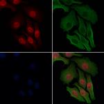Phospho-HSF1 (Ser303) Antibody in Immunocytochemistry (ICC/IF)