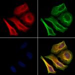 Phospho-FOXO1 (Ser319) Antibody in Immunocytochemistry (ICC/IF)