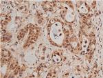 Phospho-FOXO1 (Ser319) Antibody in Immunohistochemistry (Paraffin) (IHC (P))