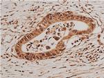 Phospho-FOXO1 (Ser319) Antibody in Immunohistochemistry (Paraffin) (IHC (P))