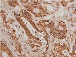 Phospho-FOXO1 (Ser319) Antibody in Immunohistochemistry (Paraffin) (IHC (P))