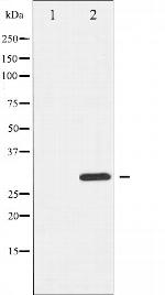Phospho-BIK (Thr33) Antibody in Western Blot (WB)