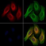 Phospho-PKC mu (Tyr463) Antibody in Immunocytochemistry (ICC/IF)