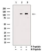 Phospho-PKC mu (Tyr463) Antibody in Western Blot (WB)