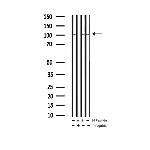 Phospho-PKD1/2/3/PKC mu (Ser738, Ser742) Antibody in Western Blot (WB)
