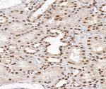 Phospho-p38 MAPK (Tyr182) Antibody in Immunohistochemistry (Paraffin) (IHC (P))