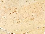 Phospho-p38 MAPK (Tyr182) Antibody in Immunohistochemistry (Paraffin) (IHC (P))