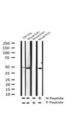 Phospho-p38 MAPK (Tyr182) Antibody in Western Blot (WB)