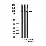 Phospho-ATRIP (Ser68) Antibody in Western Blot (WB)