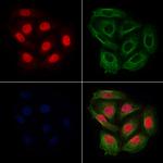 Phospho-RACGAP1 (Ser387) Antibody in Immunocytochemistry (ICC/IF)