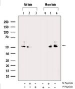 Phospho-CaMKII alpha/beta/delta (Thr305) Antibody in Western Blot (WB)