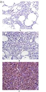 TWIST1 Antibody in Immunohistochemistry (IHC)
