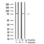 Phospho-GAB2 (Ser623) Antibody in Western Blot (WB)