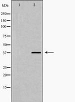 Phospho-hnRNP D (Ser83) Antibody in Western Blot (WB)