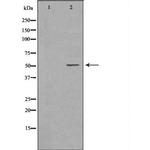 MMP8 Antibody in Western Blot (WB)