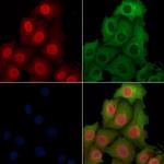 HSP70 Polyclonal Antibody