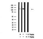 Phospho-NFkB p50/p105 (Ser903) Antibody in Western Blot (WB)