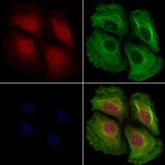 Phospho-NFkB p50/p105 (Ser923) Antibody in Immunocytochemistry (ICC/IF)
