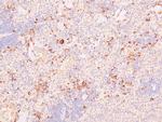 Phospho-NFkB p50/p105 (Ser923) Antibody in Immunohistochemistry (Paraffin) (IHC (P))