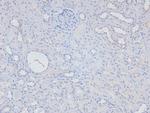 Phospho-NFkB p50/p105 (Ser923) Antibody in Immunohistochemistry (Paraffin) (IHC (P))