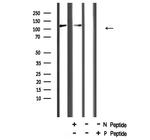 Phospho-NFkB p50/p105 (Ser923) Antibody in Western Blot (WB)