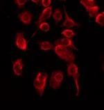 Phospho-CHK2 (Ser19) Antibody in Immunocytochemistry (ICC/IF)