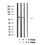 Phospho-CHK2 (Ser19) Antibody in Western Blot (WB)