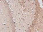Phospho-B-Myb (Thr494) Antibody in Immunohistochemistry (Paraffin) (IHC (P))