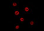Phospho-CHK2 (Thr26, Ser28) Antibody in Immunocytochemistry (ICC/IF)