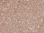 Phospho-CHK2 (Thr26, Ser28) Antibody in Immunohistochemistry (Paraffin) (IHC (P))