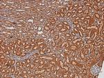 Phospho-CHK2 (Thr26, Ser28) Antibody in Immunohistochemistry (Paraffin) (IHC (P))