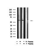 Phospho-CHK2 (Thr26, Ser28) Antibody in Western Blot (WB)