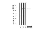 Phospho-FES (Tyr713) Antibody in Western Blot (WB)