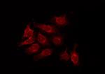 Phospho-SMAD2 (Ser245) Antibody in Immunocytochemistry (ICC/IF)