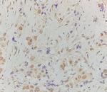 Phospho-HSF1 (Ser307) Antibody in Immunohistochemistry (Paraffin) (IHC (P))
