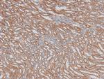 Phospho-ILK (Ser343) Antibody in Immunohistochemistry (Paraffin) (IHC (P))