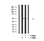 Phospho-ILK (Ser343) Antibody in Western Blot (WB)