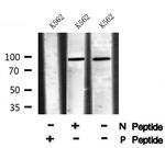 Phospho-TGFBR3 (Thr843) Antibody in Western Blot (WB)