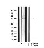 Phospho-CENTB1 (Ser554) Antibody in Western Blot (WB)