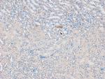 Phospho-eNOS (Ser1179) Polyclonal Antibody