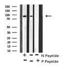 Phospho-PKD2 (Ser812) Antibody in Western Blot (WB)