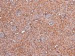 Phospho-FOXO4 (Thr455) Antibody in Immunohistochemistry (Paraffin) (IHC (P))