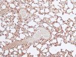 Phospho-FOXO4 (Thr455) Antibody in Immunohistochemistry (Paraffin) (IHC (P))