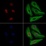 Phospho-Rb (Thr252) Polyclonal Antibody